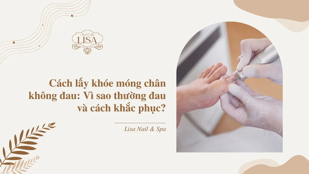 Cách lấy khóe móng chân không đau: Vì sao đau và cách khắc phục?
